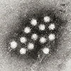 Image of Hepatitis A Virus